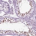 RFX3 Antibody in Immunohistochemistry (IHC)