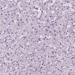 RFX3 Antibody in Immunohistochemistry (IHC)