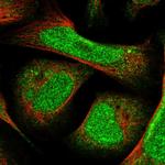 ZNF740 Polyclonal Antibody