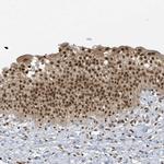 ZNF740 Antibody in Immunohistochemistry (IHC)