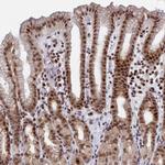 AP5Z1 Antibody in Immunohistochemistry (Paraffin) (IHC (P))