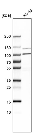 AP5Z1 Antibody in Western Blot (WB)