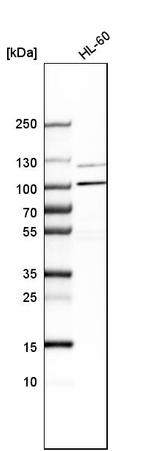 AP5Z1 Antibody in Western Blot (WB)
