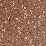 gamma Adducin Antibody in Immunohistochemistry (Paraffin) (IHC (P))