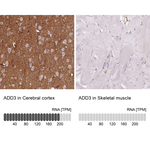 gamma Adducin Antibody in Immunohistochemistry (Paraffin) (IHC (P))