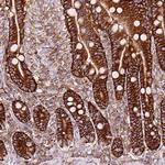 gamma Adducin Antibody in Immunohistochemistry (Paraffin) (IHC (P))
