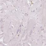 gamma Adducin Antibody in Immunohistochemistry (Paraffin) (IHC (P))