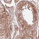 gamma Adducin Antibody in Immunohistochemistry (Paraffin) (IHC (P))