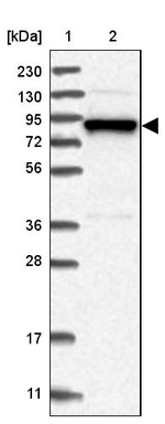 gamma Adducin Antibody in Western Blot (WB)