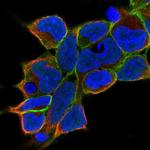 gamma Adducin Polyclonal Antibody