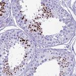 HMGB4 Polyclonal Antibody