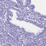 HMGB4 Antibody in Immunohistochemistry (IHC)