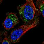 CES4A Polyclonal Antibody