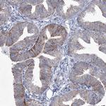 CES4A Antibody in Immunohistochemistry (IHC)