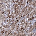 CES4A Antibody in Immunohistochemistry (IHC)