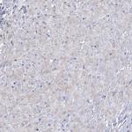 CES4A Antibody in Immunohistochemistry (IHC)