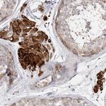 ARV1 Antibody in Immunohistochemistry (Paraffin) (IHC (P))
