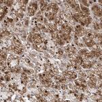 Gemin 6 Polyclonal Antibody