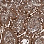 UNC93A Polyclonal Antibody