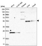 UNC93A Antibody in Western Blot (WB)