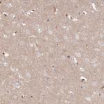 SERC1 Antibody in Immunohistochemistry (Paraffin) (IHC (P))