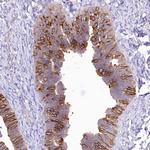 LRRC34 Antibody in Immunohistochemistry (Paraffin) (IHC (P))