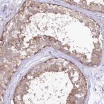 LRRC34 Antibody in Immunohistochemistry (Paraffin) (IHC (P))