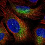 ZBTB45 Polyclonal Antibody