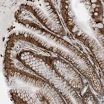 ZBTB45 Antibody in Immunohistochemistry (Paraffin) (IHC (P))