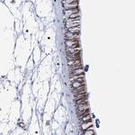 THAP6 Antibody in Immunohistochemistry (Paraffin) (IHC (P))