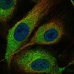 MMRN1 Polyclonal Antibody