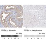 MMRN1 Antibody in Immunohistochemistry (IHC)