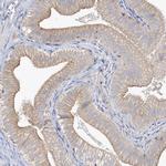 MMRN1 Antibody in Immunohistochemistry (IHC)