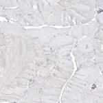 MMRN1 Antibody in Immunohistochemistry (IHC)