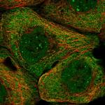 PHF22 Polyclonal Antibody