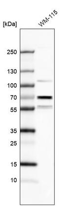 PHF22 Antibody in Western Blot (WB)