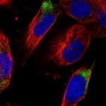 DPP3 Polyclonal Antibody