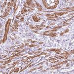 DPP3 Antibody in Immunohistochemistry (Paraffin) (IHC (P))