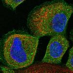 ALS2CR12 Polyclonal Antibody