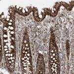 MRPS36 Antibody in Immunohistochemistry (Paraffin) (IHC (P))