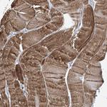 TRIM60 Polyclonal Antibody