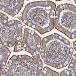 TRIM60 Polyclonal Antibody