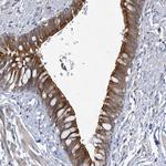 CLEC16A Antibody in Immunohistochemistry (Paraffin) (IHC (P))