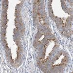 CLEC16A Antibody in Immunohistochemistry (Paraffin) (IHC (P))