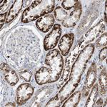 CLEC16A Antibody in Immunohistochemistry (Paraffin) (IHC (P))