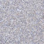 CLEC16A Antibody in Immunohistochemistry (Paraffin) (IHC (P))