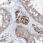 CLEC16A Antibody in Immunohistochemistry (Paraffin) (IHC (P))