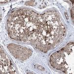 CLEC16A Antibody in Immunohistochemistry (IHC)