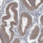 CLEC16A Antibody in Immunohistochemistry (IHC)