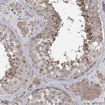 CLEC16A Polyclonal Antibody